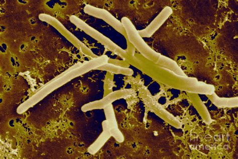 mycobacterium smegmatis|mycobacterium smegmatis characteristics.